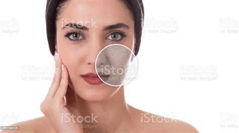 Beautiful Woman Face With Dry Skin Stock Photo Download Image Now