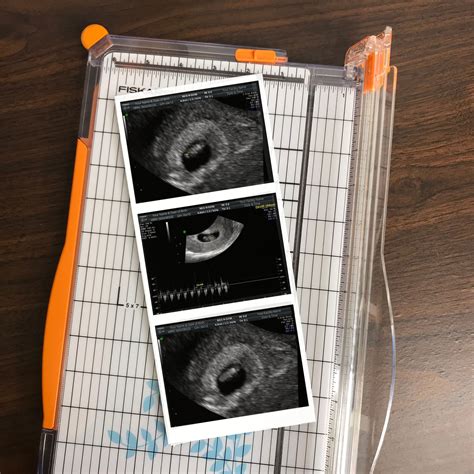 Fake Ultrasound Pictures Fake sonogram Prank Ultrasound | Etsy