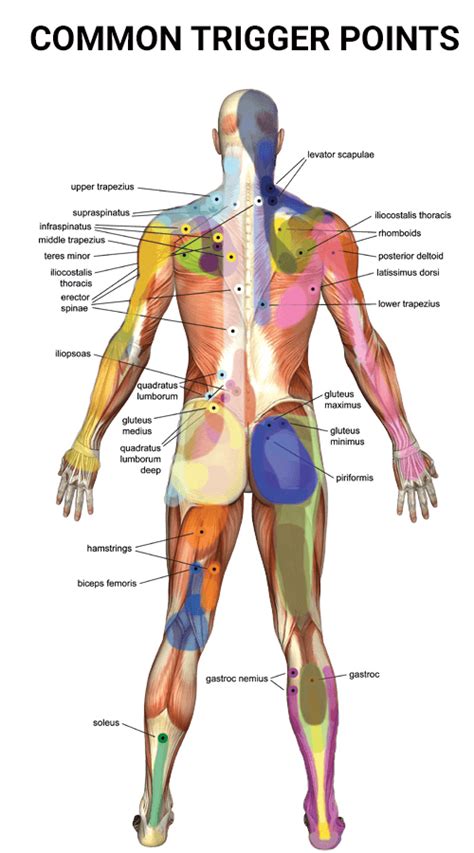 Trigger Point Therapy Physical Therapists Nyc