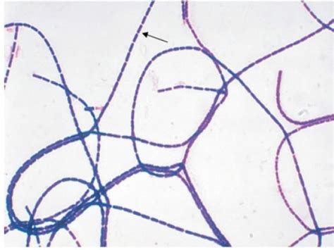 Gram Positive Rods