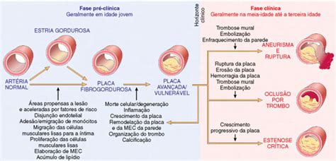 Aterosclerose Definição Epidemiologia Patogênese E Complicações
