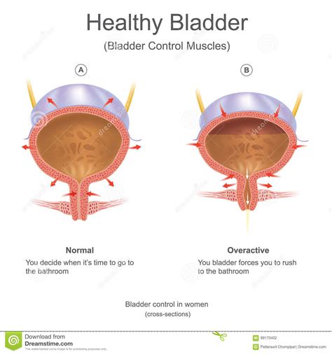 Another part of a woman's body that men enjoy looking at and find attractive and women secretly love to be touched and kissed is the nape of the neck. Healthy bladder in women. stock vector. Illustration of parts - 99170402