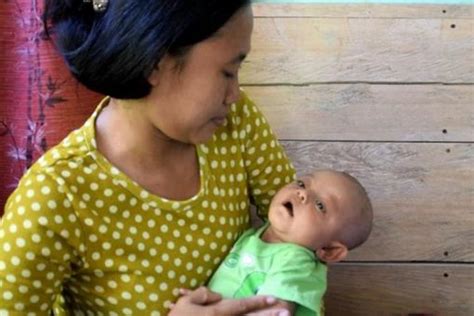 Cara merawat demam bukanlah sesuatu yang rumit lagi kerana teknologi perubatan sudah berkembang maju. Anak Bayi Sakit Campak - Baby Love