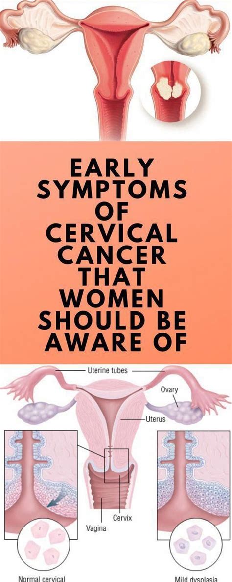 Cervical Cancer Types