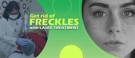 Laser Treatment For Freckles Cost In India Laser Treatment In Hyderabad