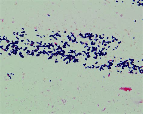 Gram Stain Of A Blood Culture Indicates The Presence Of Gram Positive