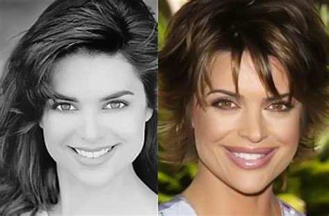 Lisa Rinna Before And After Plastic Surgery 03 Celebrity Plastic