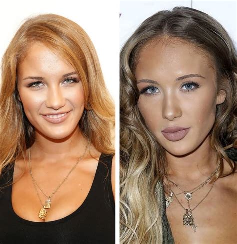 Niykee Heaton Avant Et Après La Transformation Campus Verge