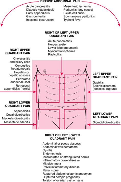 Abdominal Pain Causes Symptoms Treatment Abdominal Pain