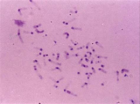 Formerly called cercopithecus aethiops, this group of monkeys has been split into several different species). C-banded metaphase chromosomes of Vero cell line ...