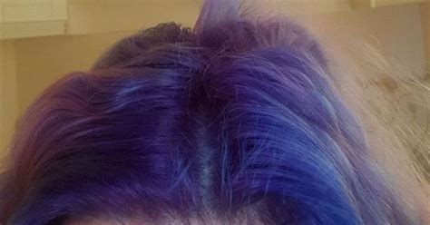 Lauras Hair Turned Blue And Started To Come Out In Clumps Get Surrey