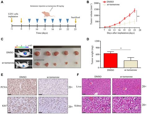 Ar Turmerone Inhibits The Proliferation And Mobility Of Glioma By