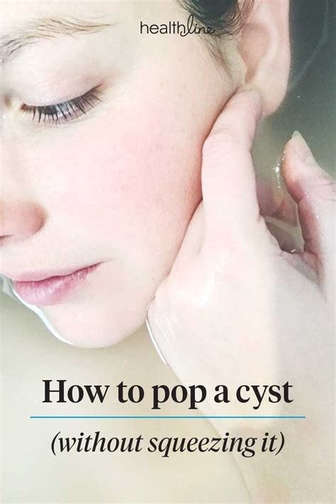 How To Pop A Cyst On Your Face Back At Home And More Cyst Acne