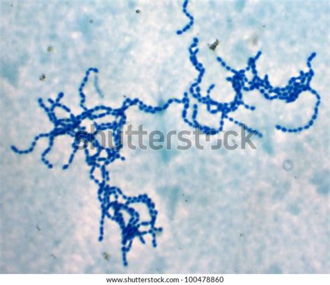 Bacterial Cells Chains Streptococcus Pyogenes Photo Stock Photo Edit