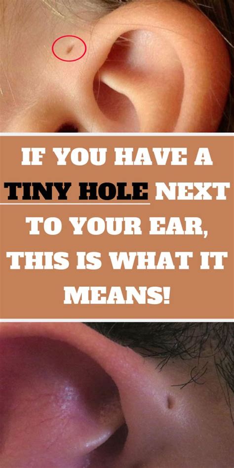 Did You Ever Wonder What This Tiny Hole Next To Your Ear Is There For