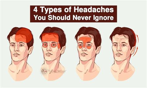 Types Of Headaches Chart By Location