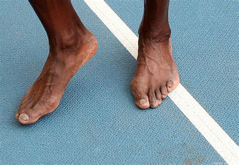 NBA Player Feet: What's up with them Nasty Toes ...