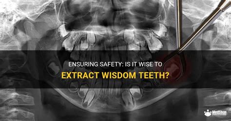 Ensuring Safety Is It Wise To Extract Wisdom Teeth Medshun