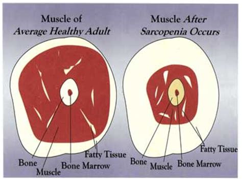 Check spelling or type a new query. Use it or Lose it: Muscles and Aging - CityWide SuperSlow