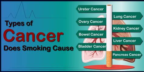 How Does Smoking Tobacco Can Cause Cancer