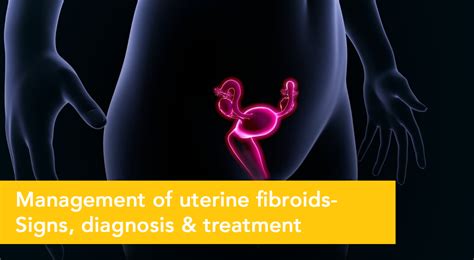 Uterine Fibroids Types Signs And Treatments