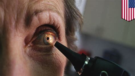 Ocular Damage