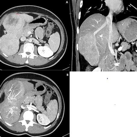 View Of Contrast Enhanced Multidetector Computed Tomography Axial And