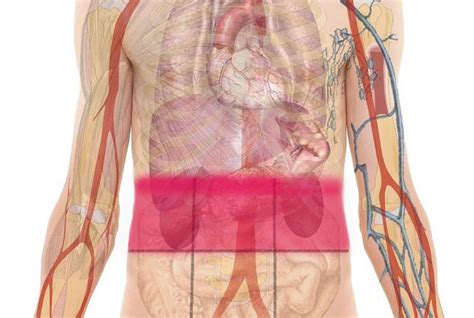 ¿dolor Abdominal Este Mapa Revelará Lo Que Causa Tu Dolor