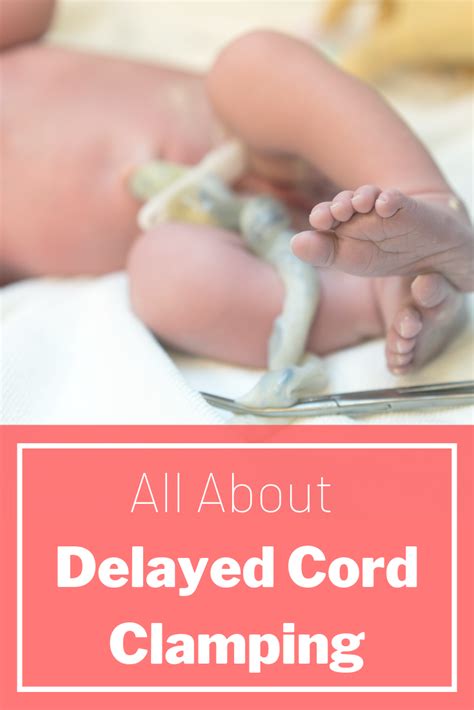 Delayed Cord Clamping With Images Cord Clamping Delayed Cord Clamping Preterm Birth