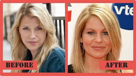 Candace Cameron Plastic Surgery The Real Story Candace Cameron