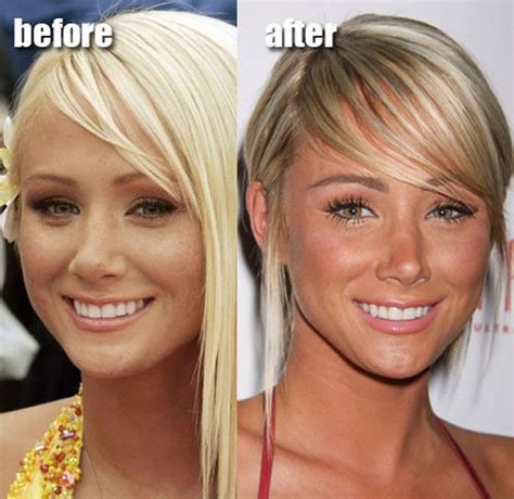 Sara Underwood Plastic Surgery Before After Celebrity Plastic