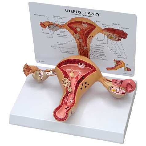 Anatomia Do Colo Uterino