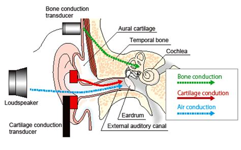 Cartilage Conduction Hearing Aids The Third Pathway For Sound