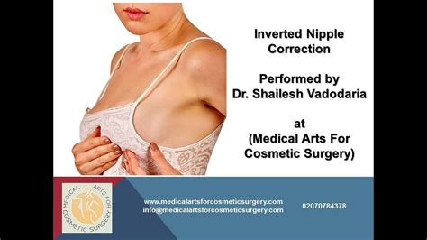 Detailed Steps Involved In Inverted Nipple Correction Procedure YouTube