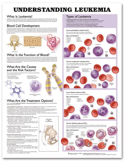 Understanding Leukemia Chart 9781587799761 Blood Cancer Poster