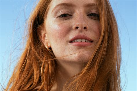 It is mainly found on the face, but also on the chest, upper arms, shoulders, and back. What's the Best Sunscreen for Cystic Acne? A Derm Weighs In.