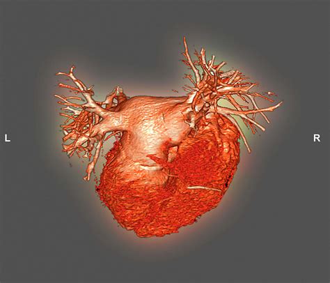 Heart Photograph By Zephyrscience Photo Library