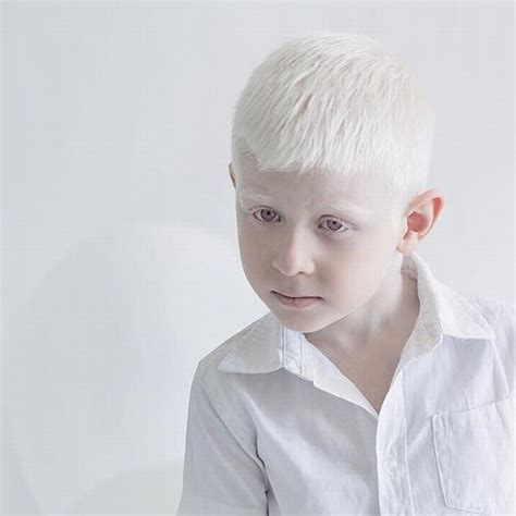 Stunning Portraits Showing Albinism S Beauty