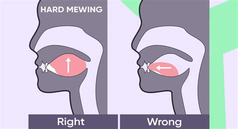 Mewing Is Hard Or Uncomfortable Heres What To Do Ach