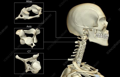 The Bones Of The Head And Neck Stock Image F0013871 Science