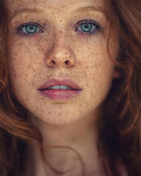 Schöne Sommersprossen Red Hair Freckles Freckles Girl Redheads Freckles