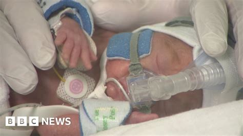 Breakthrough Lung Treatment Saving Premature Babies Bbc News