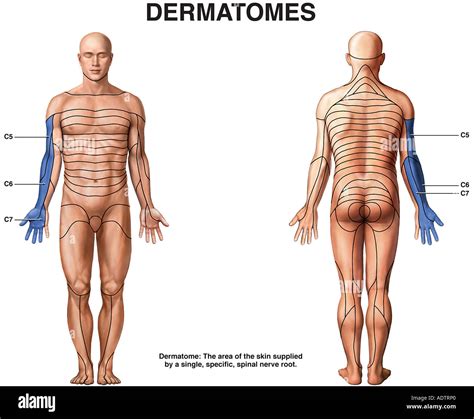 Dermatomes Fotos Und Bildmaterial In Hoher Aufl Sung Alamy The