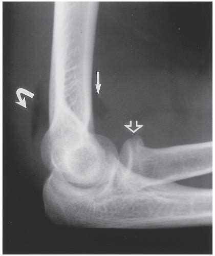 Upper Limb Ii Elbow Radiology Key