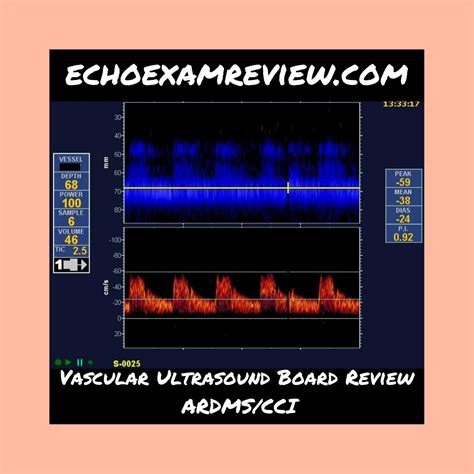 Vascular Ultrasound Board Review Ardmscci What Vessel Is Being