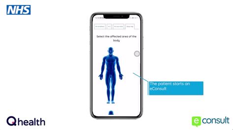 Please be advised that we are experiencing heavy traffic on our platform as more users and priority groups use ezconsult to book. eConsult and Q health combined patient journey - YouTube