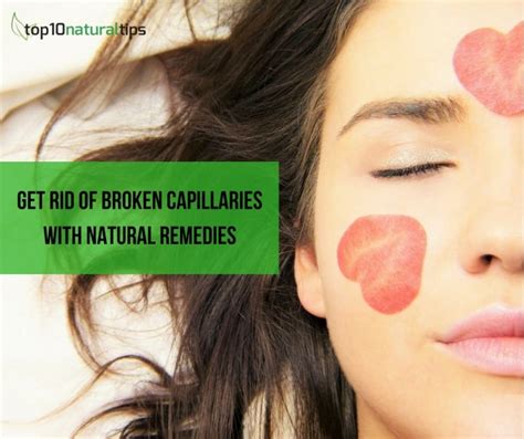 How To Get Rid Of Broken Capillaries On Face Naturally Top10 Natural Tips