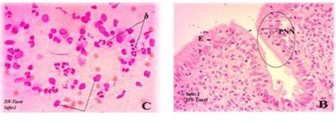 The Endometrial Biopsies And Cytology Samples Images B Endometrial