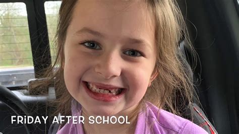 Josie Loses Her 2 Front Teeth Youtube