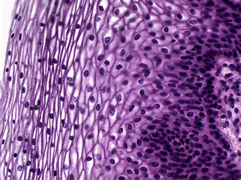 Human Vagina Light Micrograph Stock Image C Science